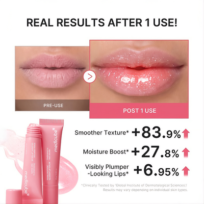 PDRN Peptide Glossy Lip Balm – Hydrating Plumping Lip Gloss